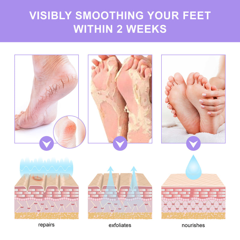 Exfoliating Foot Mask Feet Cream For Dead Skin Removal Foot Skin Foot Peeling