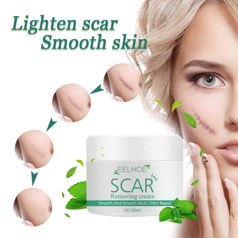 Skin Smoothing And Repairing Cream For Scalding And Burn Scars